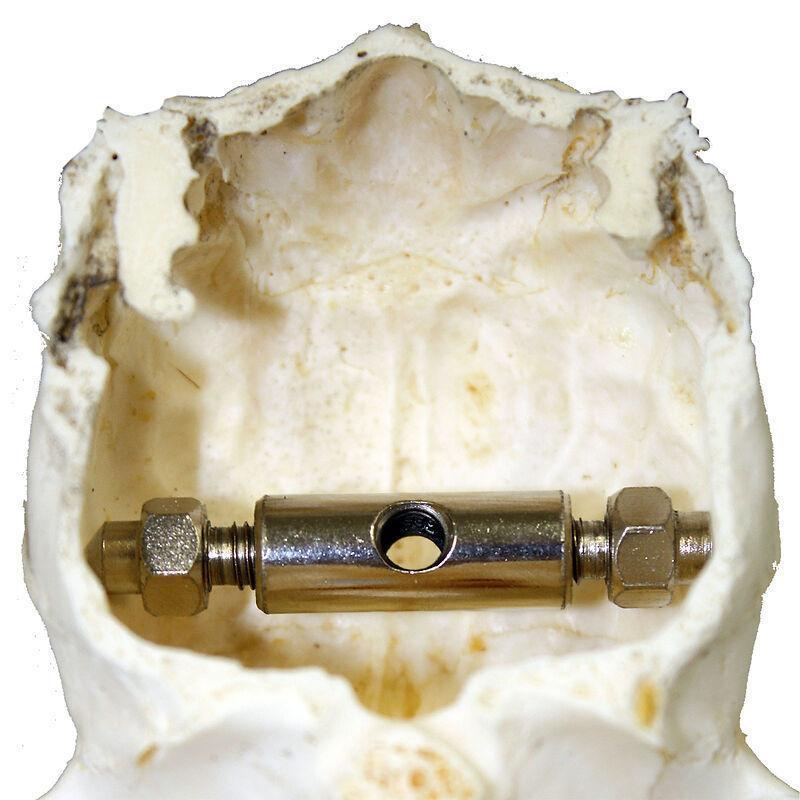 Trófea tartó TROPHÄENHALTER REHWILD      A2